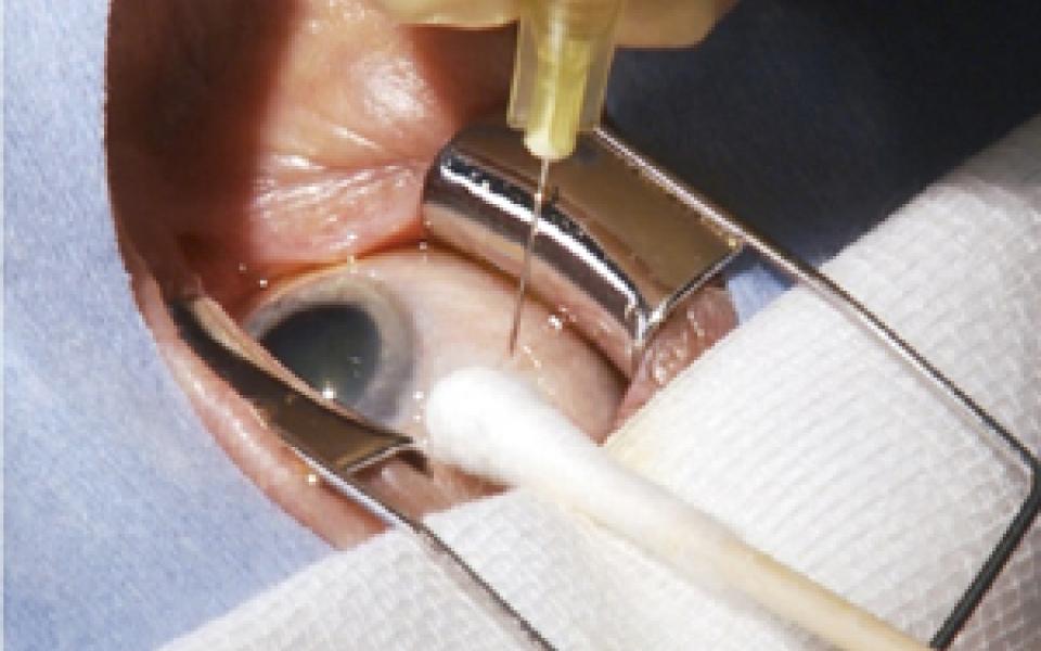 Eye injection is the current treatment method for retinal disease.