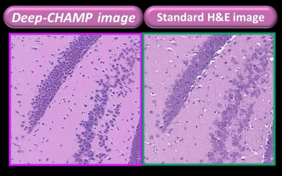 Comparison of the tissue images presented by the microscope developed by PhoMedics (left) and the FFPE tissue (right) – existing gold standard methodology for cancer cell imaging. The former can be displayed within three minutes while the latter takes about a week.