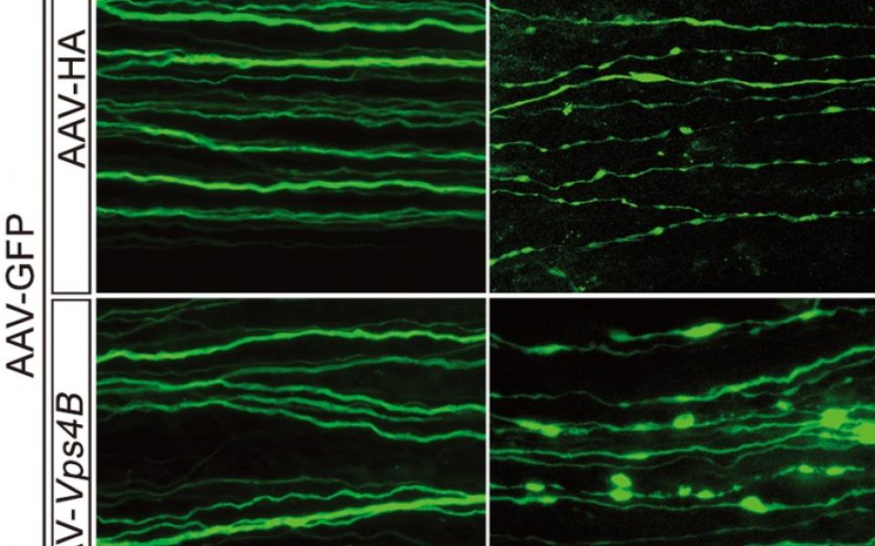 Integrity of the injured nerve is apparently more intact (bottom right) within three days after upregulation of Vps4 than that which have not been regulated (upper right).