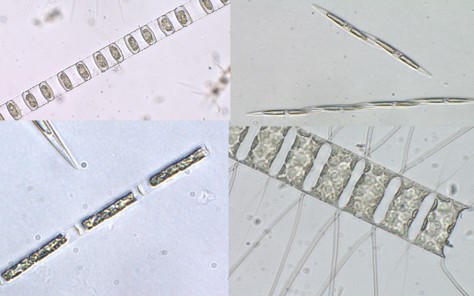 显微镜下的硅藻