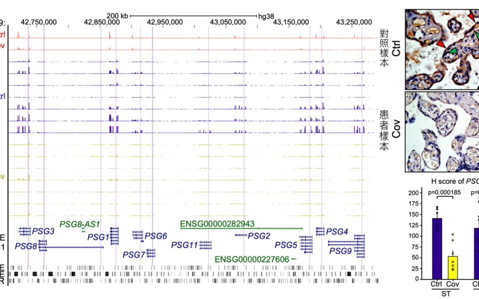 Samples of COVID-19 patients show the loss of PSG proteins in placental cells and reduced PSG gene expression, which could affect the placental development.